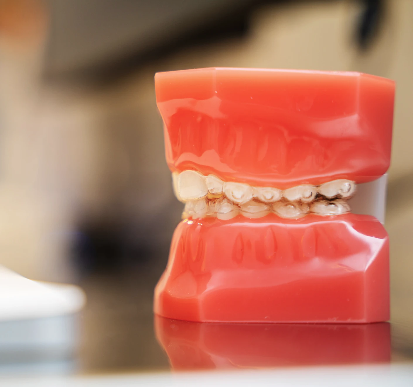 traitement orthodontie bruxelles bianchi