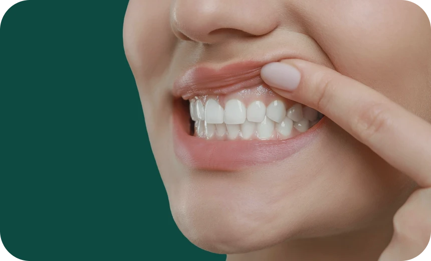 parodontite-orthodontie-bruxelles